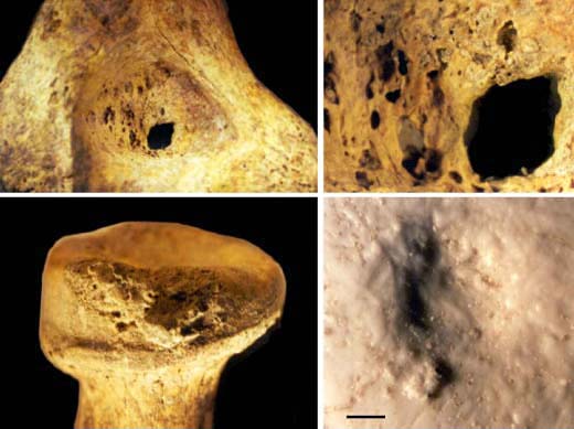 Kennewick Man's bones